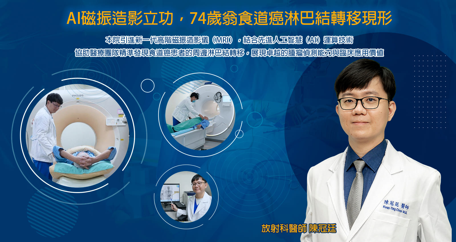 AI磁振造影立功，74歲翁食道癌淋巴結轉移現形
