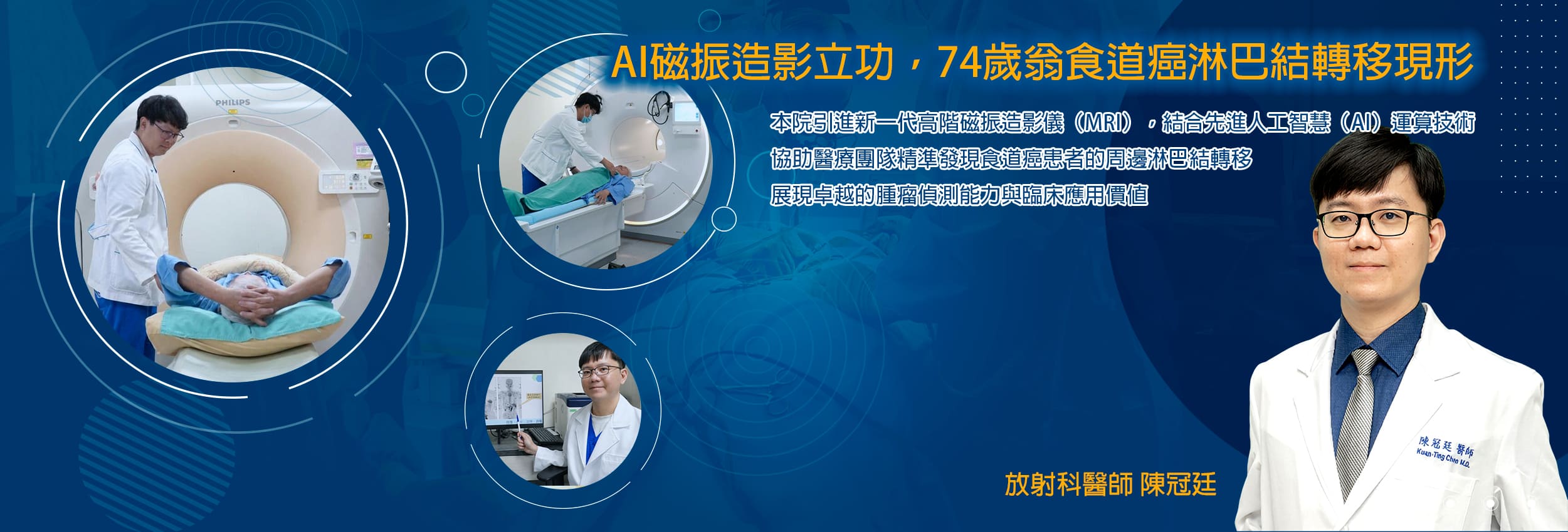 AI磁振造影立功，74歲翁食道癌淋巴結轉移現形